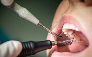 Inflammation Around Dental Implant: Causes, Symptoms, and Treatment