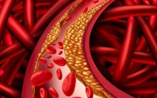 Bempedoic Acid: Statin Alternative