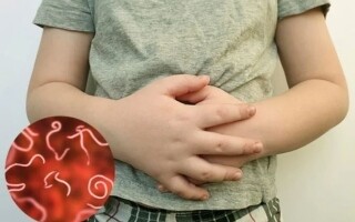 Understanding Pinworm Symptoms and Prevention